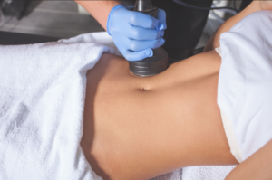 non-surgical liposuction
